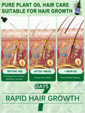 Hair growth essential oil, treatment for hair loss, baldness